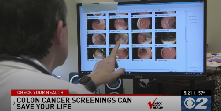 Doctor looking at images of colons for colon cancer screening